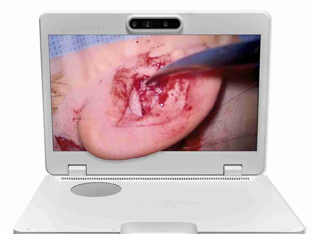 达擎之＂Heads-up 3D显微手术显示系统＂，，整合4K裸眼3D显示及眼球追踪系统，，，，具备快速追踪人眼移动位置功能，，，减轻医师长时间维持固定姿势的负担，，，让医师能有更宽广清晰的3D立体视野及更舒适的姿势来执行手术。。。